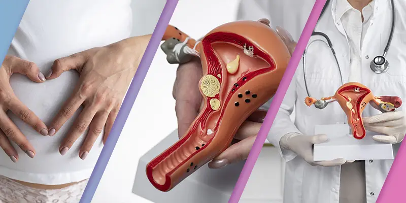 Preparazione dell'endometrio e finestra d'impianto per il transfer nella gestazione per altri.